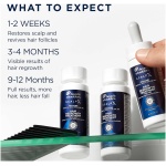 Head & Shoulders Scalp X 5% 米諾地爾生髮治療 – 男士專用 (60ml/支）| 3 瓶裝 （3 個月用量）